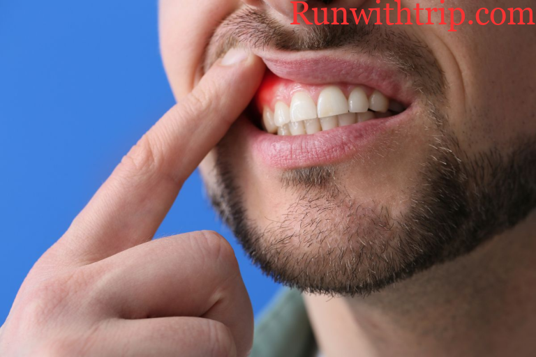 How Gum Surgery Can Improve Your Oral Health