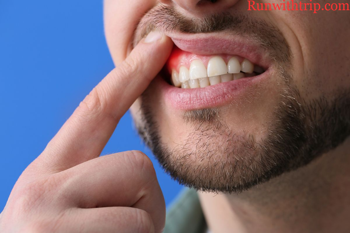 How Gum Surgery Can Improve Your Oral Health
