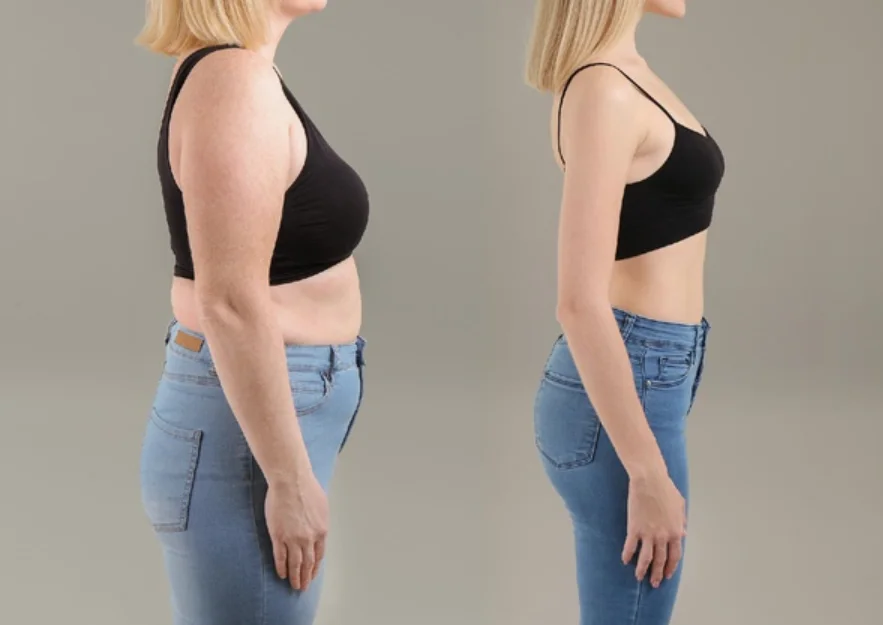 How Mommy Makeovers Can Improve Core Strength and Posture